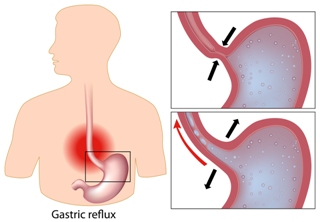 001 science-gastric-reflex